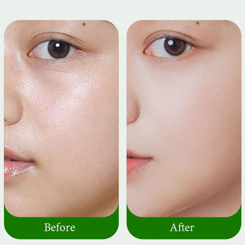 100pcs Facial Oil Absorbing Paper Facial Absorbent Paper Face Oil Removing Sheets Makeup Tool Skin Care Products for Women-Health Wisdom™