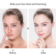 10pcs Hyaluronic Acid Face Mask Moisturizing Refreshing Anti-wrinkle Anti-aging Facial Masks Face Sheet Mask Korean Skin Care-Health Wisdom™