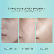 10pcs Hyaluronic Acid Hydrating Facial Mask Sheet Masks for Face Hydrating Shrinking Pores Moisturizing Face Masks Skin Care-Health Wisdom™