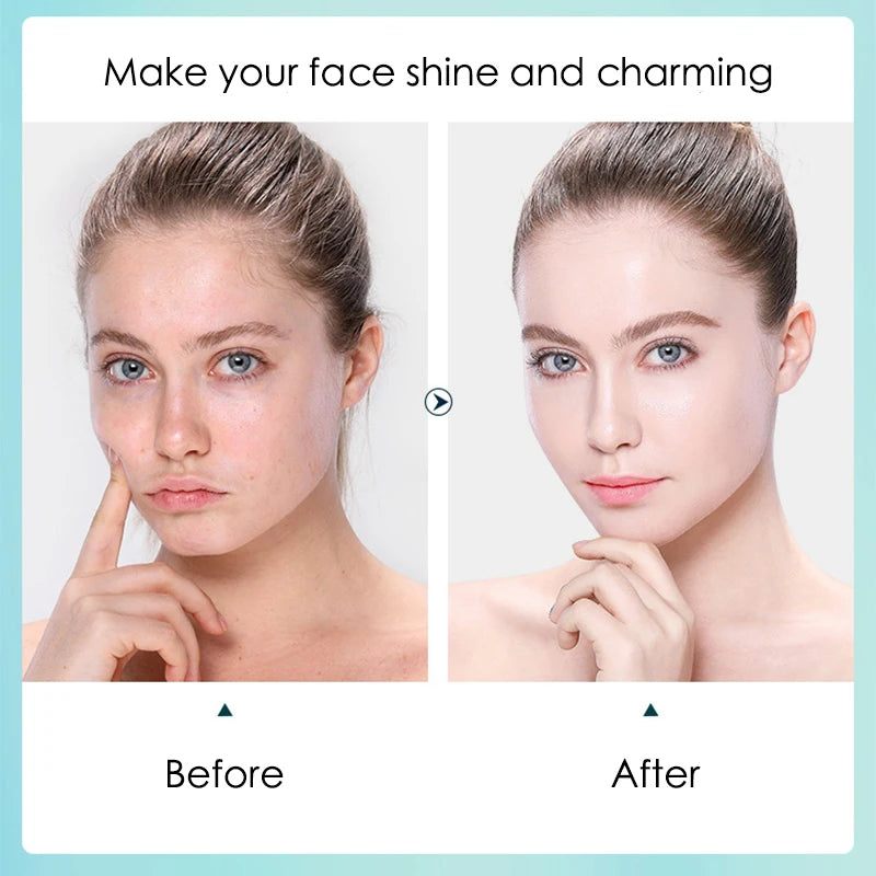 10pcs Hyaluronic Acid Hydrating Facial Mask Sheet Masks for Face Hydrating Shrinking Pores Moisturizing Face Masks Skin Care-Health Wisdom™