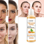 118ml Turmeric Moisturizing Toner Acne Remover Reduce Dullness & Black Spots Firming Skin Toner Essence Toner for Skin Whitening-Health Wisdom™