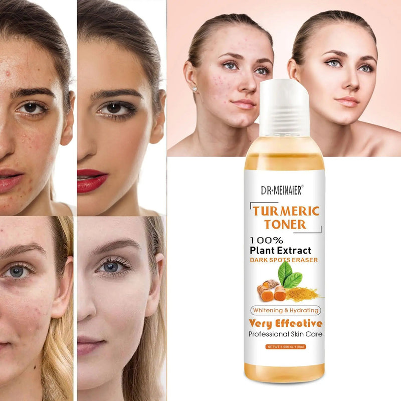 118ml Turmeric Moisturizing Toner Acne Remover Reduce Dullness & Black Spots Firming Skin Toner Essence Toner for Skin Whitening-Health Wisdom™