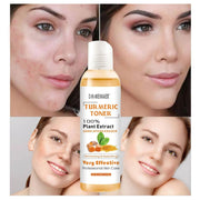 118ml Turmeric Moisturizing Toner Acne Remover Reduce Dullness & Black Spots Firming Skin Toner Essence Toner for Skin Whitening-Health Wisdom™