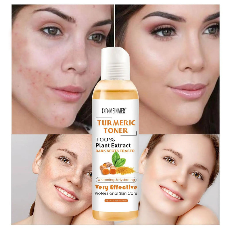 118ml Turmeric Moisturizing Toner Acne Remover Reduce Dullness & Black Spots Firming Skin Toner Essence Toner for Skin Whitening-Health Wisdom™