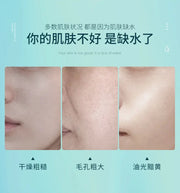 12 Pieces Hyaluronic Acid Facial Mask Sheet Pores Moisturizing Oil-Control Anti-Aging Replenishment Whitening Aloe Face Care-Health Wisdom™