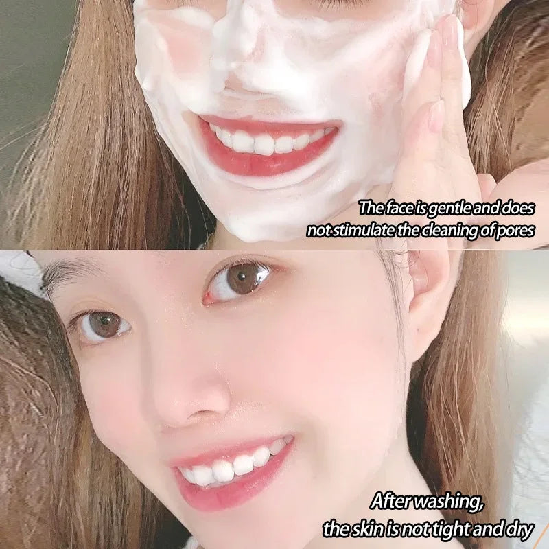 120ml Amino Acid Facial Cleanser, Deep Gentle Cleansing, Oil Control, Purifying Cleansing Honey Face Exfoliator-Health Wisdom™