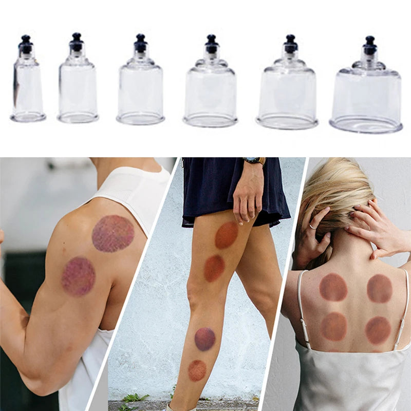 17 Cans Vacuum Cupping Therapy Set Plastic Vacuum Cups Massager Medical Suction Cups Jars Therapy Cupping Set for Massage-Health Wisdom™