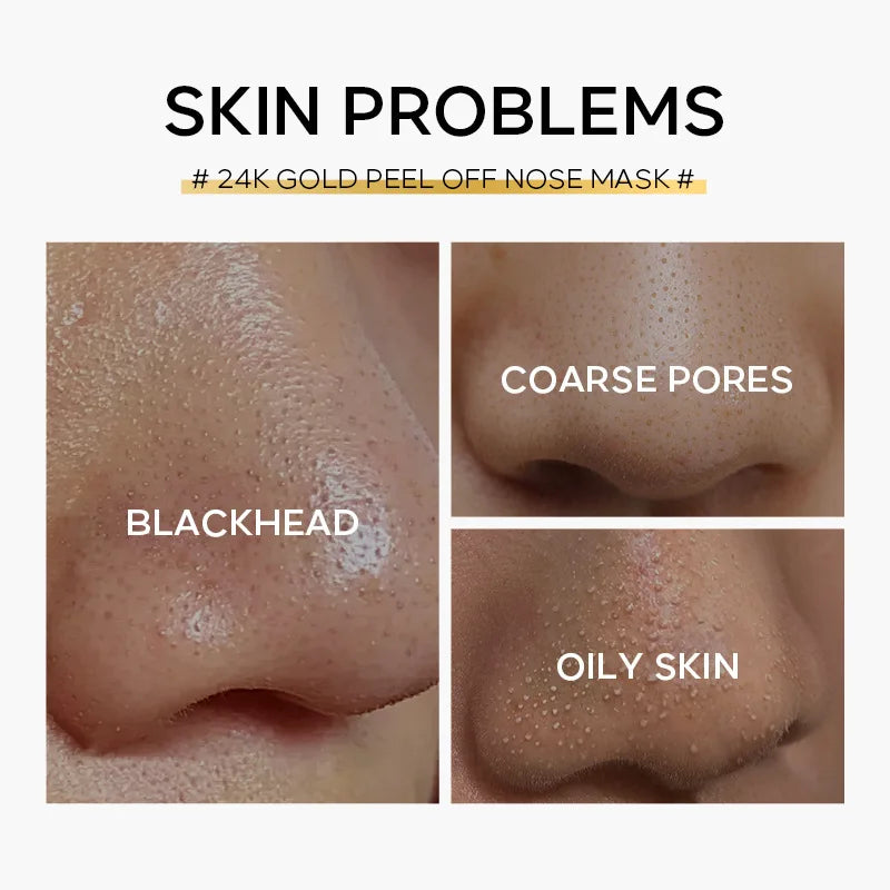 24K Gold Blackhead Removal Mask Deep Cleaning Moisturizing Remove Black Head Peel Off Nose Mask Blackhead Remover Peeling Masks-Health Wisdom™