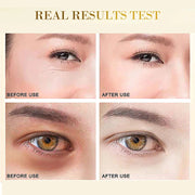 24K Gold Hyaluronic Acid Eye Mask to get rid of under-eye bags skin care products collagen eye patch Korean cosmetics Beauty-Health Wisdom™