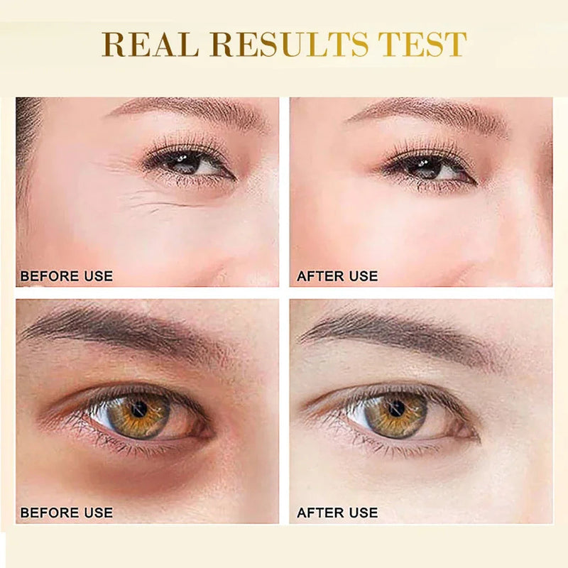 24K Gold Hyaluronic Acid Eye Mask to get rid of under-eye bags skin care products collagen eye patch Korean cosmetics Beauty-Health Wisdom™