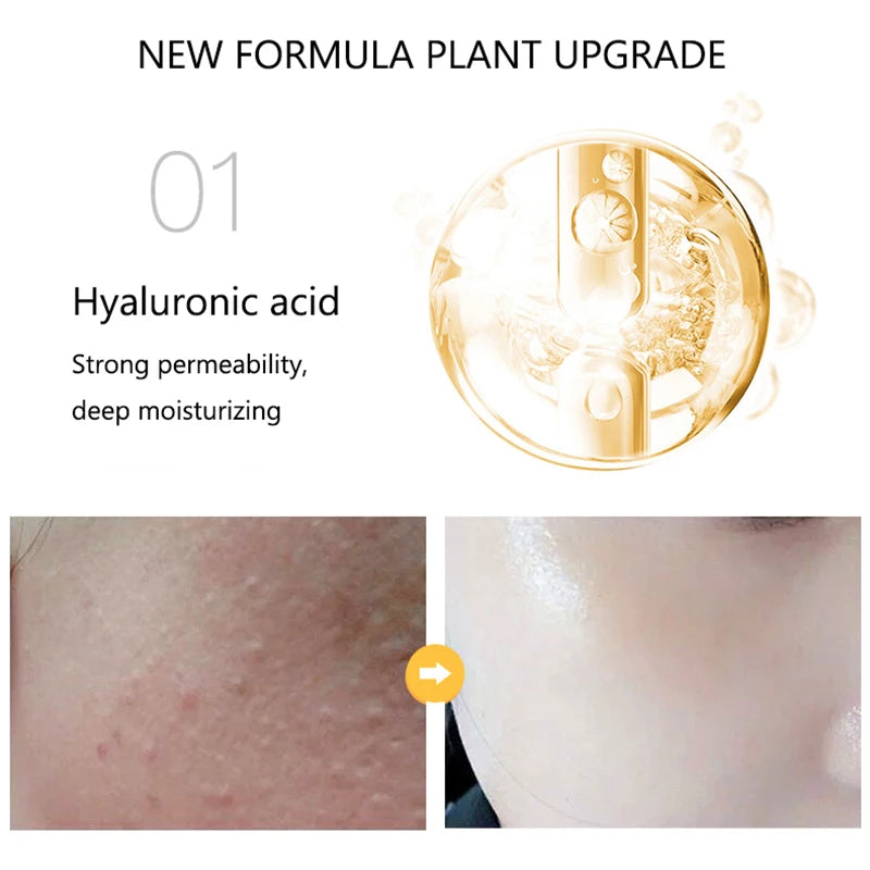 24K Golden Niacinamide Essence Liquid Deeply Nourishes Anti Wrinkles Anti Aging Hyaluronic Acid Nourish Skin Facial Moisturizer-Health Wisdom™