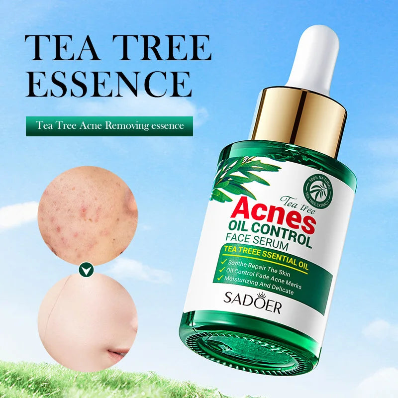 30ml Tea Tree Acne Removing Face Essence Oil Controlling Acne Printing Skin Care Product Moisturizing Facial Anti Acne Essence-Health Wisdom™