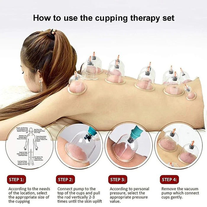 32 Cupping Therapy Set Vacuum Cupping Cup Body Massager Suction Cups Chinese Herbal Physiotherapy Vacuum Cups Heathy Care