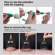 32 Cupping Therapy Set Vacuum Cupping Cup Body Massager Suction Cups Chinese Medicine Physiotherapy Vacuum Cups Heathy Care-Health Wisdom™