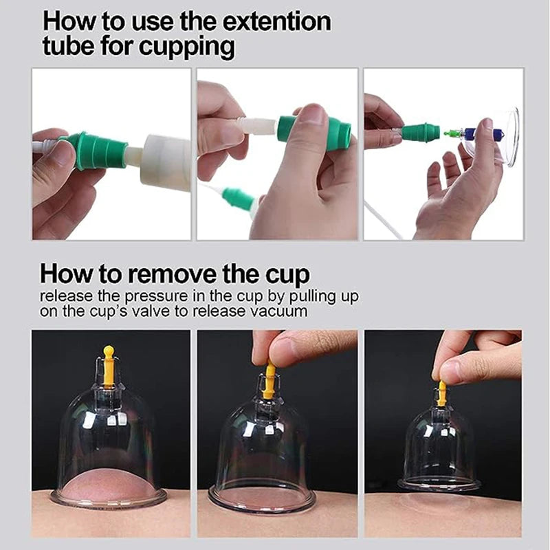 32 Cupping Therapy Set Vacuum Cupping Cup Body Massager Suction Cups Chinese Medicine Physiotherapy Vacuum Cups Heathy Care-Health Wisdom™