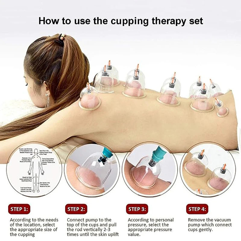 32 Cupping Therapy Set Vacuum Cupping Cup Body Massager Suction Cups Chinese Medicine Physiotherapy Vacuum Cups Heathy Care-Health Wisdom™