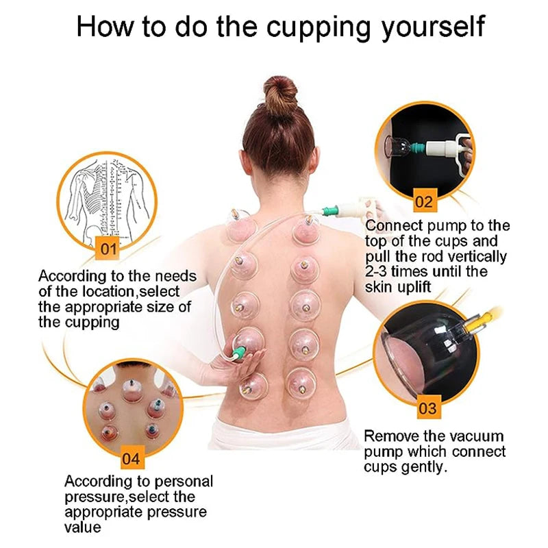 32 Cupping Therapy Set Vacuum Cupping Cup Body Massager Suction Cups Chinese Medicine Physiotherapy Vacuum Cups Heathy Care-Health Wisdom™