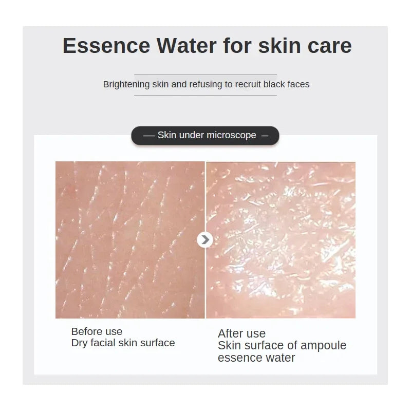 500ml Hyaluronic Acid Facial Essence Moisturizing Whiten Pore Shrink Anti-aging Freckle Anti Wrinkle VC Niacinamide Face Serum-Health Wisdom™