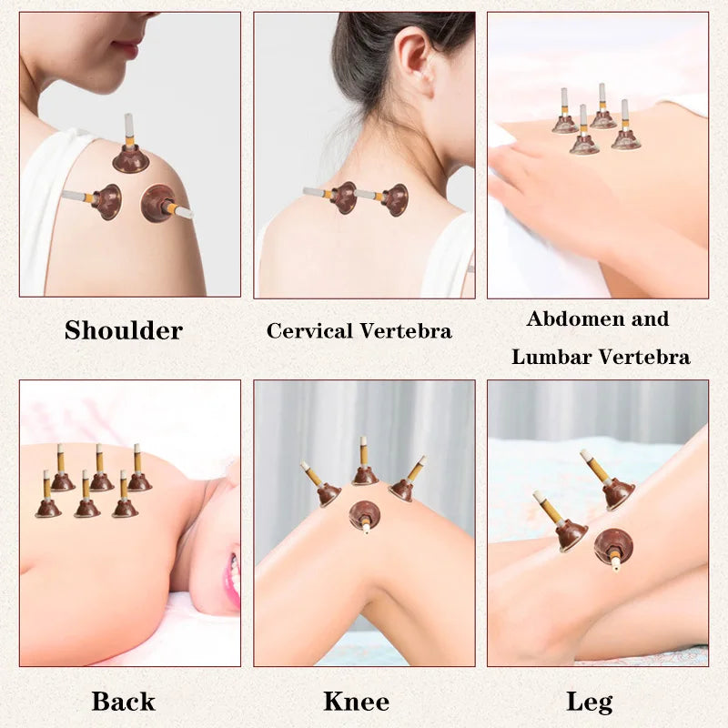 50Pcs Moxa Stick Moxibustion Stickers Chinese Medicine Moxas Therapy Acupuncture Foot Back Massager For Neck Warm Uterus Stomach-Health Wisdom™
