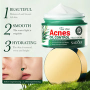 50g Tea Tree Acne Removing and Oil Control Face Cream Acne Printing Facial Anti Acne Skin Care Product Moisturizing Face Cream-Health Wisdom™