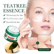 50g Tea Tree Acne Removing and Oil Control Face Cream Acne Printing Facial Anti Acne Skin Care Product Moisturizing Face Cream-Health Wisdom™