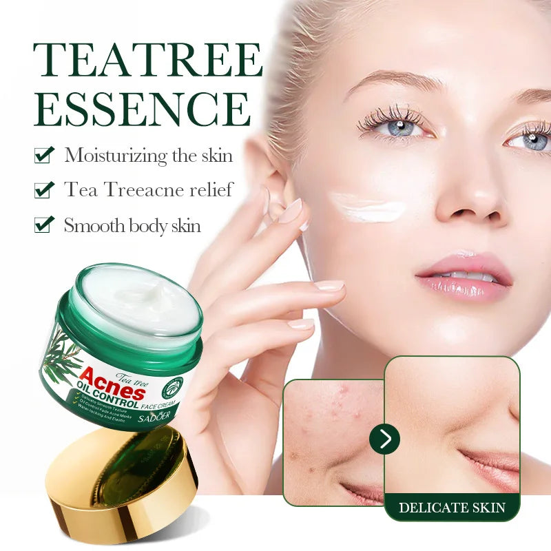 50g Tea Tree Acne Removing and Oil Control Face Cream Acne Printing Facial Anti Acne Skin Care Product Moisturizing Face Cream-Health Wisdom™