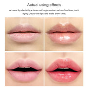 5PCS Lemon Vitamin Essence Moisturizing Lip Mask Anti Crack Fade Lip Lines Lip Patch Soften Dead Skin Anti Chipping Gel Lip Mask-Health Wisdom™