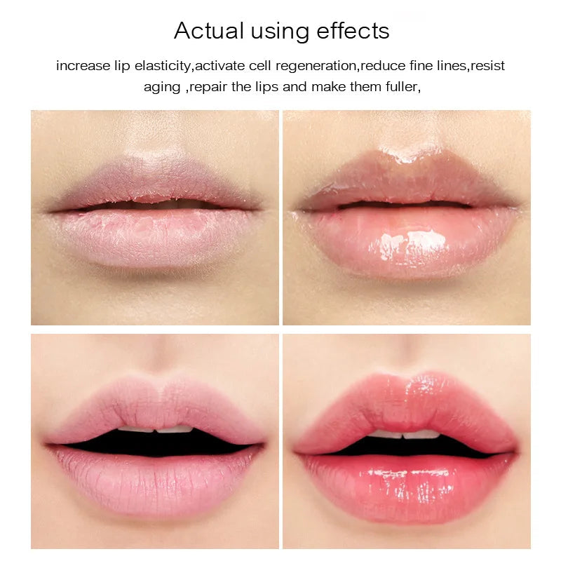 5PCS Lemon Vitamin Essence Moisturizing Lip Mask Anti Crack Fade Lip Lines Lip Patch Soften Dead Skin Anti Chipping Gel Lip Mask-Health Wisdom™