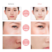 7 Color LED Facial Mask w/ Neck Face Care Treatment Beauty Anti Acne Korean Photon Therapy Face Whiten Skin Rejuvenation Machine-Health Wisdom™