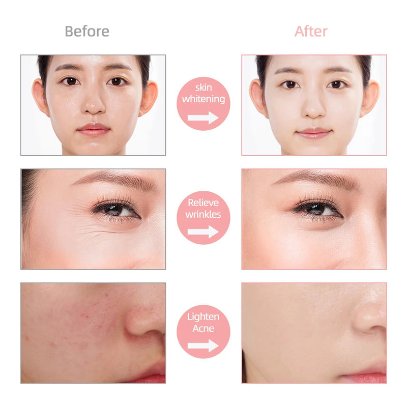 7 Color LED Facial Mask w/ Neck Face Care Treatment Beauty Anti Acne Korean Photon Therapy Face Whiten Skin Rejuvenation Machine-Health Wisdom™