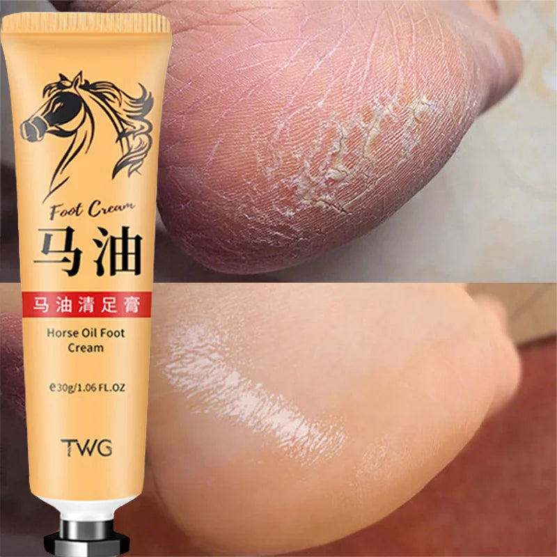 Anti Crack Foot Cream Heel Cracked Repair Horse Oil Cream Smooth Removal Dead Skin Callus Anti-Drying Hand Feet Skin Care 30g-Health Wisdom™