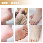 Anti Crack Foot Cream Heel Cracked Repair Horse Oil Cream Smooth Removal Dead Skin Callus Anti-Drying Hand Feet Skin Care 30g-Health Wisdom™