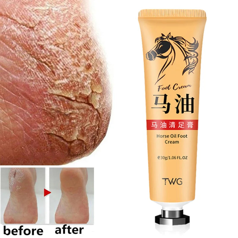 Anti Crack Foot Cream Heel Cracked Repair Horse Oil Cream Smooth Removal Dead Skin Callus Anti-Drying Hand Feet Skin Care 30g-Health Wisdom™