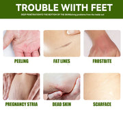 Anti Crack Foot Cream Heel Cracked Repair Horse Oil Cream Smooth Removal Dead Skin Callus Anti-Drying Hand Feet Skin Care 30g-Health Wisdom™