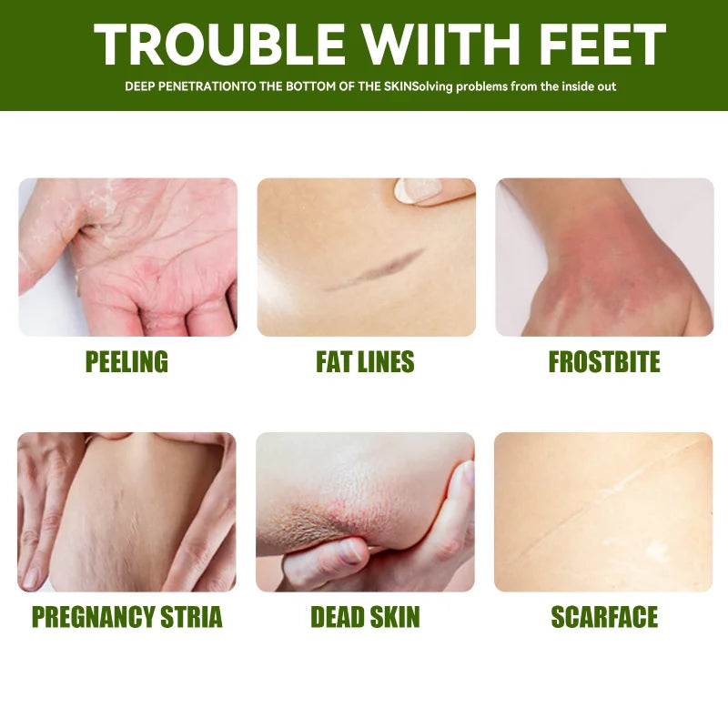 Anti Crack Foot Cream Heel Cracked Repair Horse Oil Cream Smooth Removal Dead Skin Callus Anti-Drying Hand Feet Skin Care 30g-Health Wisdom™