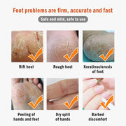 Anti Crack Foot Cream Oil Anti-Drying Crack Foot Cream Heel Cracked Repair Cream Removal Dead Skin Hand Feet Care Mask-Health Wisdom™