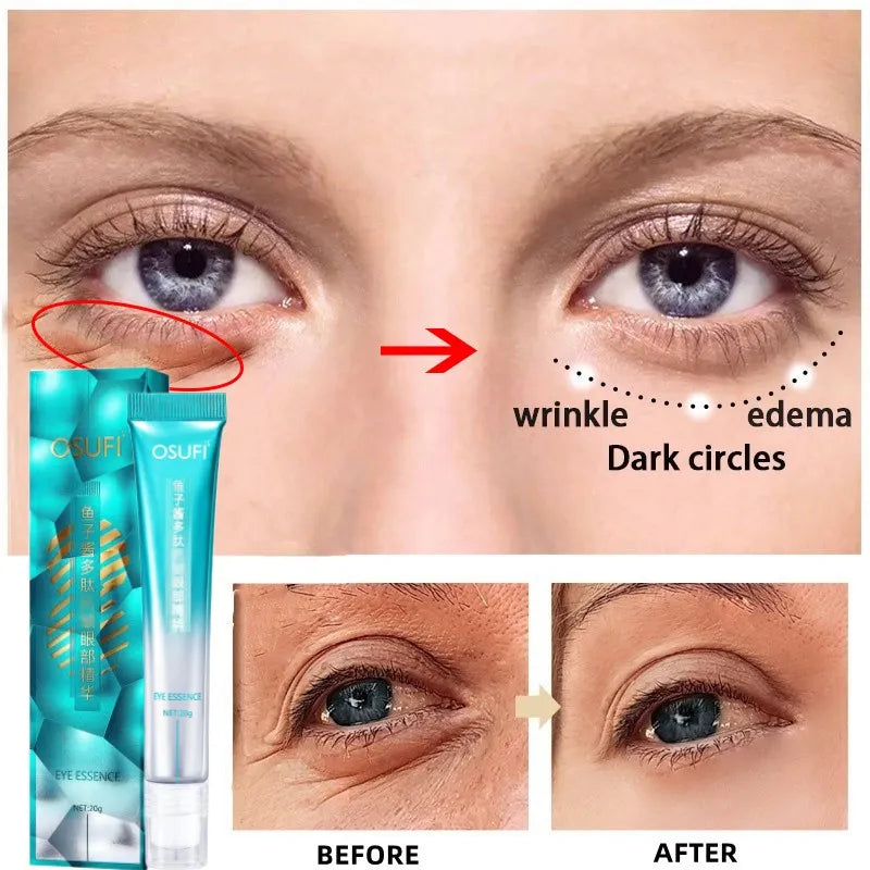 Anti-Wrinkle Eye Cream Fade Fine Lines Anti Dark Circles Eyes Serum Remove Eye Bags Puffiness Anti-Aging Firming Eye Care-Health Wisdom™