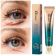 Anti Wrinkle Retinol Eye Cream Anti Dark Circles Eye Bags Removal Moisturizing Eye Creams Eyes Skin Care Products for Beauty-Health Wisdom™