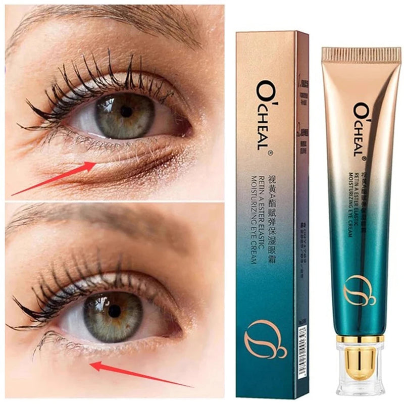 Anti Wrinkle Retinol Eye Cream Anti Dark Circles Eye Bags Removal Moisturizing Eye Creams Eyes Skin Care Products for Beauty-Health Wisdom™