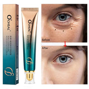 Anti Wrinkle Retinol Eye Cream Anti Dark Circles Eye Bags Removal Moisturizing Eye Creams Eyes Skin Care Products for Beauty-Health Wisdom™