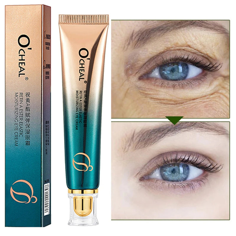 Anti Wrinkle Retinol Eye Cream Anti Dark Circles Eye Bags Removal Moisturizing Eye Creams Eyes Skin Care Products for Beauty-Health Wisdom™