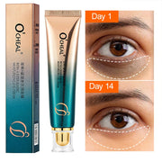 Anti Wrinkle Retinol Eye Cream Anti Dark Circles Eye Bags Removal Moisturizing Eye Creams Eyes Skin Care Products for Beauty-Health Wisdom™