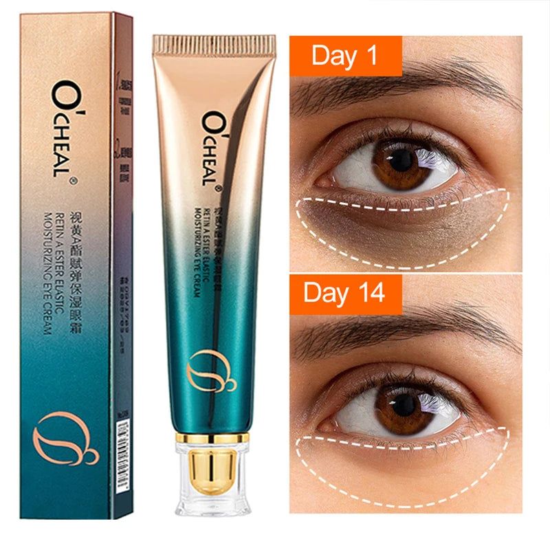 Anti Wrinkle Retinol Eye Cream Anti Dark Circles Eye Bags Removal Moisturizing Eye Creams Eyes Skin Care Products for Beauty-Health Wisdom™