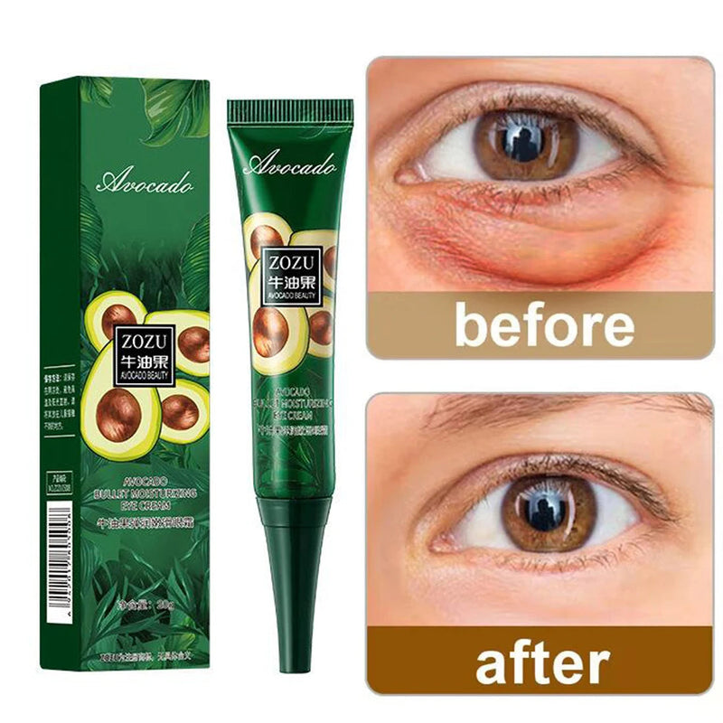 Avocado Eye Cream Anti Dark Circles Removal Eye Bags Puffiness Moisturizing Anti Wrinkle Eyes Creams Skin Care Prdoucts-Health Wisdom™