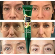Avocado Eye Cream Anti Dark Circles Removal Eye Bags Puffiness Moisturizing Anti Wrinkle Eyes Creams Skin Care Prdoucts-Health Wisdom™