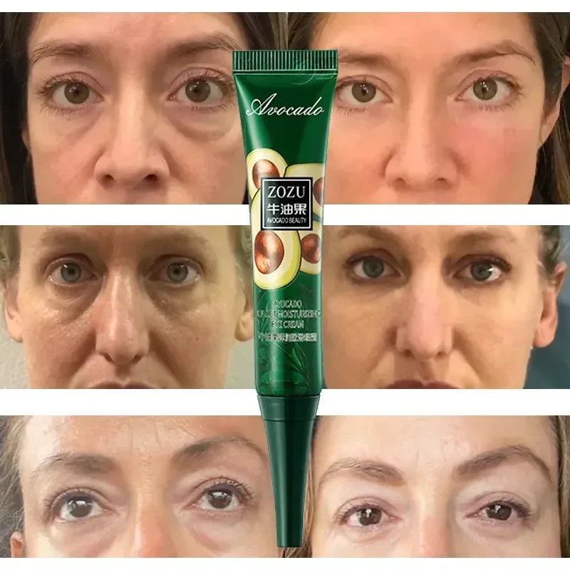 Avocado Eye Cream Anti Dark Circles Removal Eye Bags Puffiness Moisturizing Anti Wrinkle Eyes Creams Skin Care Prdoucts-Health Wisdom™