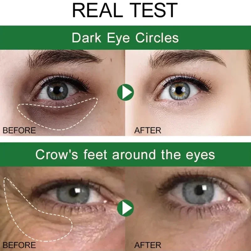 Avocado Eye Cream Anti Dark Circles Removal Eye Bags Puffiness Moisturizing Anti Wrinkle Eyes Creams Skin Care Prdoucts-Health Wisdom™