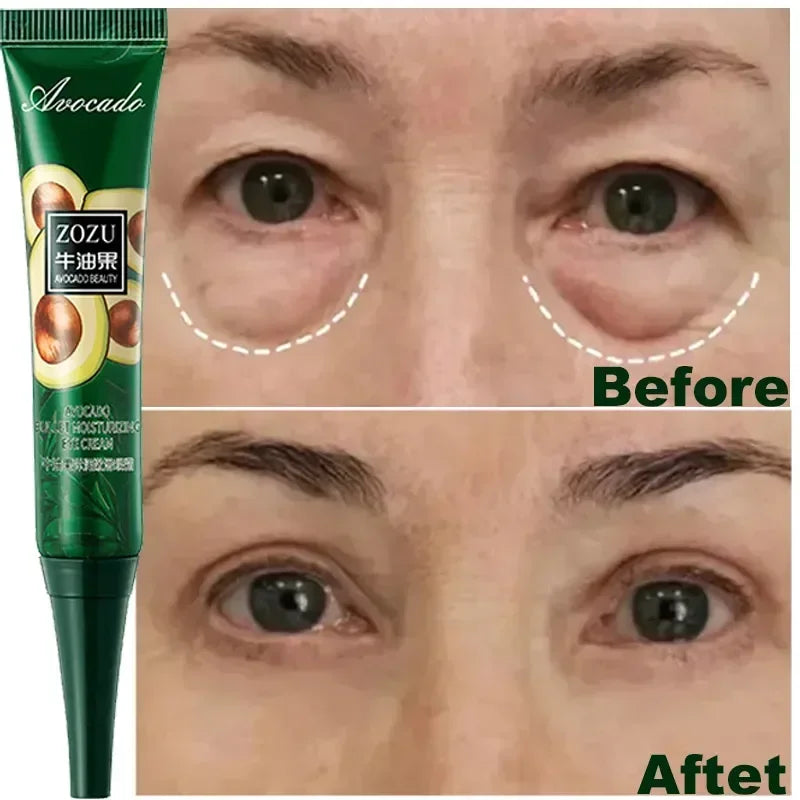 Avocado Eye Cream Anti Dark Circles Removal Eye Bags Puffiness Moisturizing Anti Wrinkle Eyes Creams Skin Care Prdoucts-Health Wisdom™