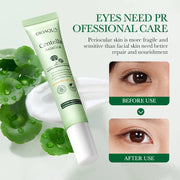 BIOAQUA Centella Eye Cream Anti Dark Circles Eyes Bags Moisturizing Anti Wrinkle Anti-aging Beauty Eyes Skin Care Products-Health Wisdom™