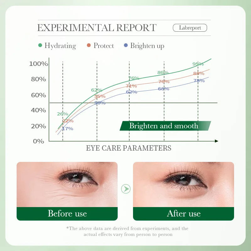 BIOAQUA Centella Eye Cream Anti Dark Circles Eyes Bags Moisturizing Anti Wrinkle Anti-aging Beauty Eyes Skin Care Products-Health Wisdom™